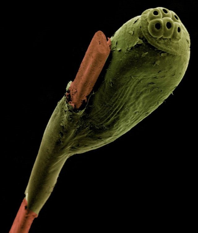 A head louse’s egg attached to a strand of human hair; Photo: Kevin Mackenzie, University of Aberdeen 
